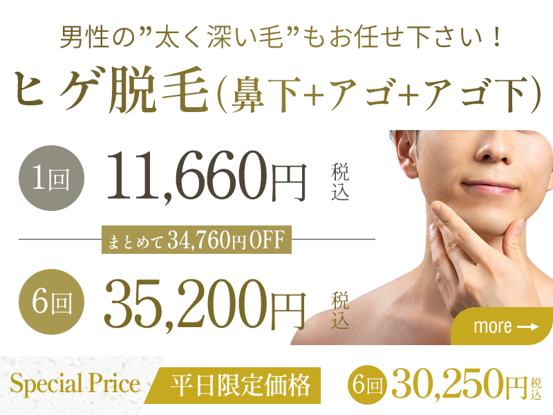 メンズヒゲ脱毛
