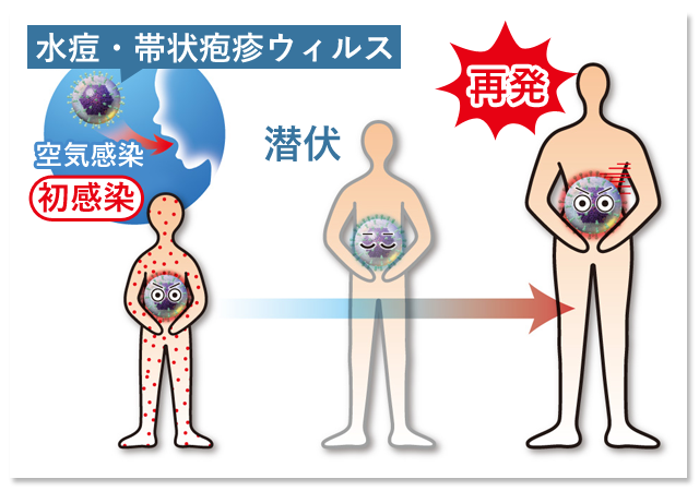 水痘にかかったことのない人でも帯状疱疹にかかることがありますか?