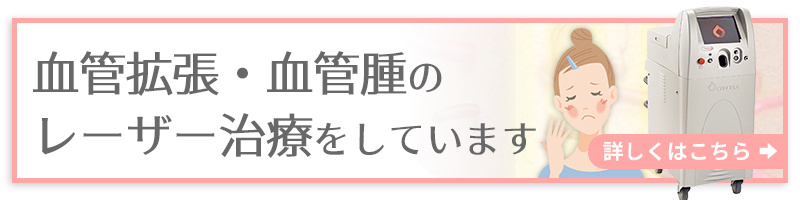 血管拡張・血管腫のレーザー治療