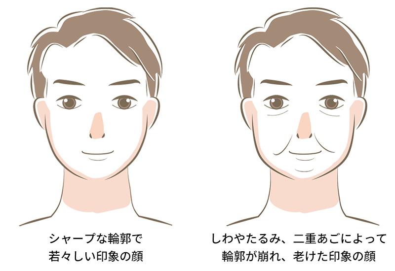 たるみによる年齢の印象