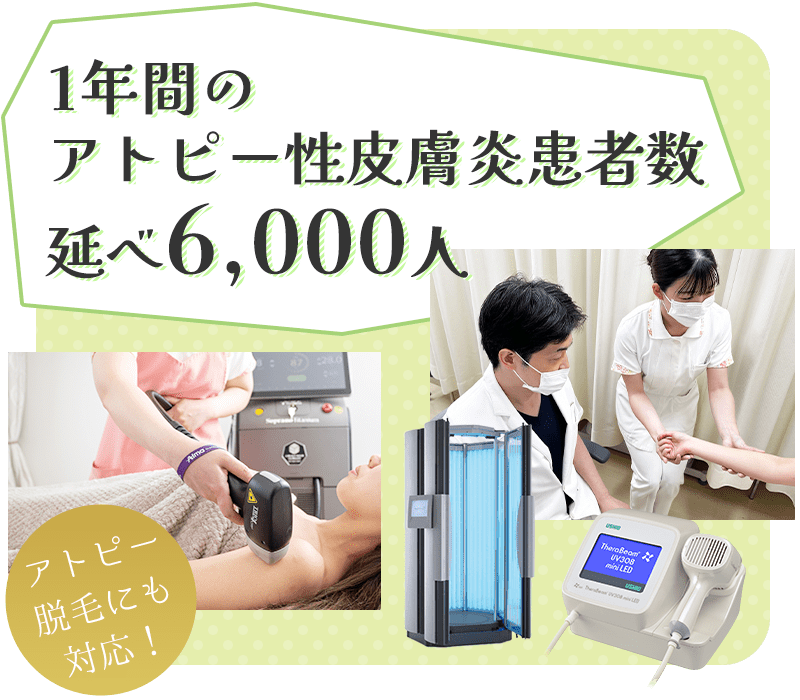 年間アトピー性皮膚炎患者6,000人